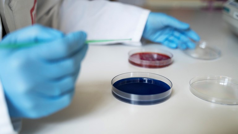 Utstryk agar.